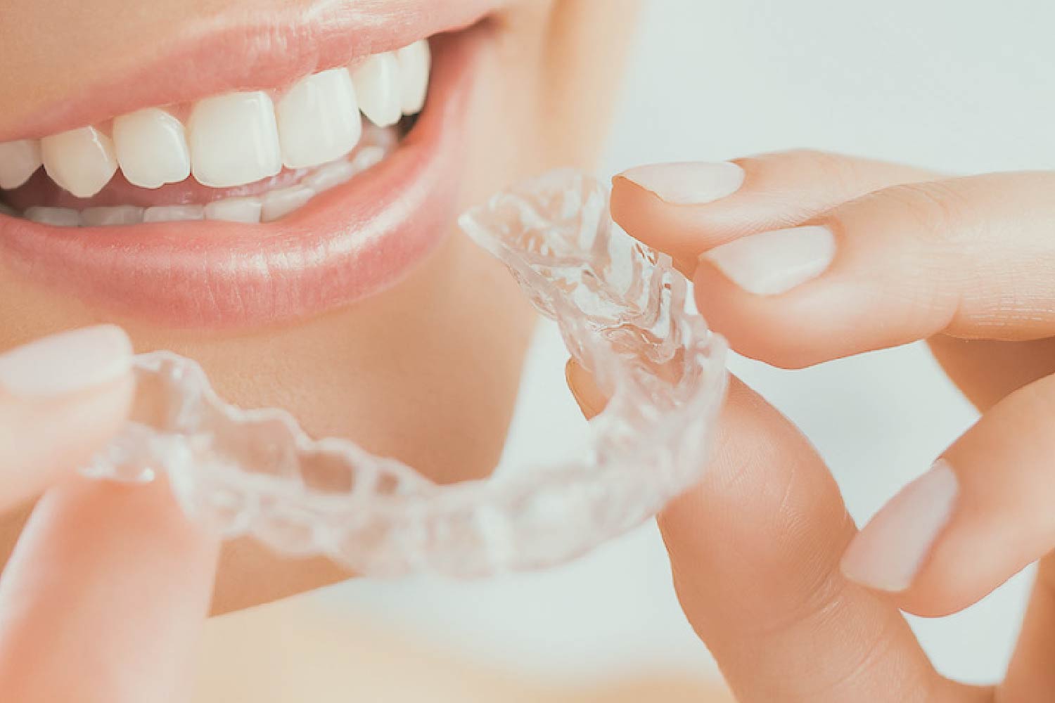 The effects of brief daily vibration on clear aligner orthodontic treatment